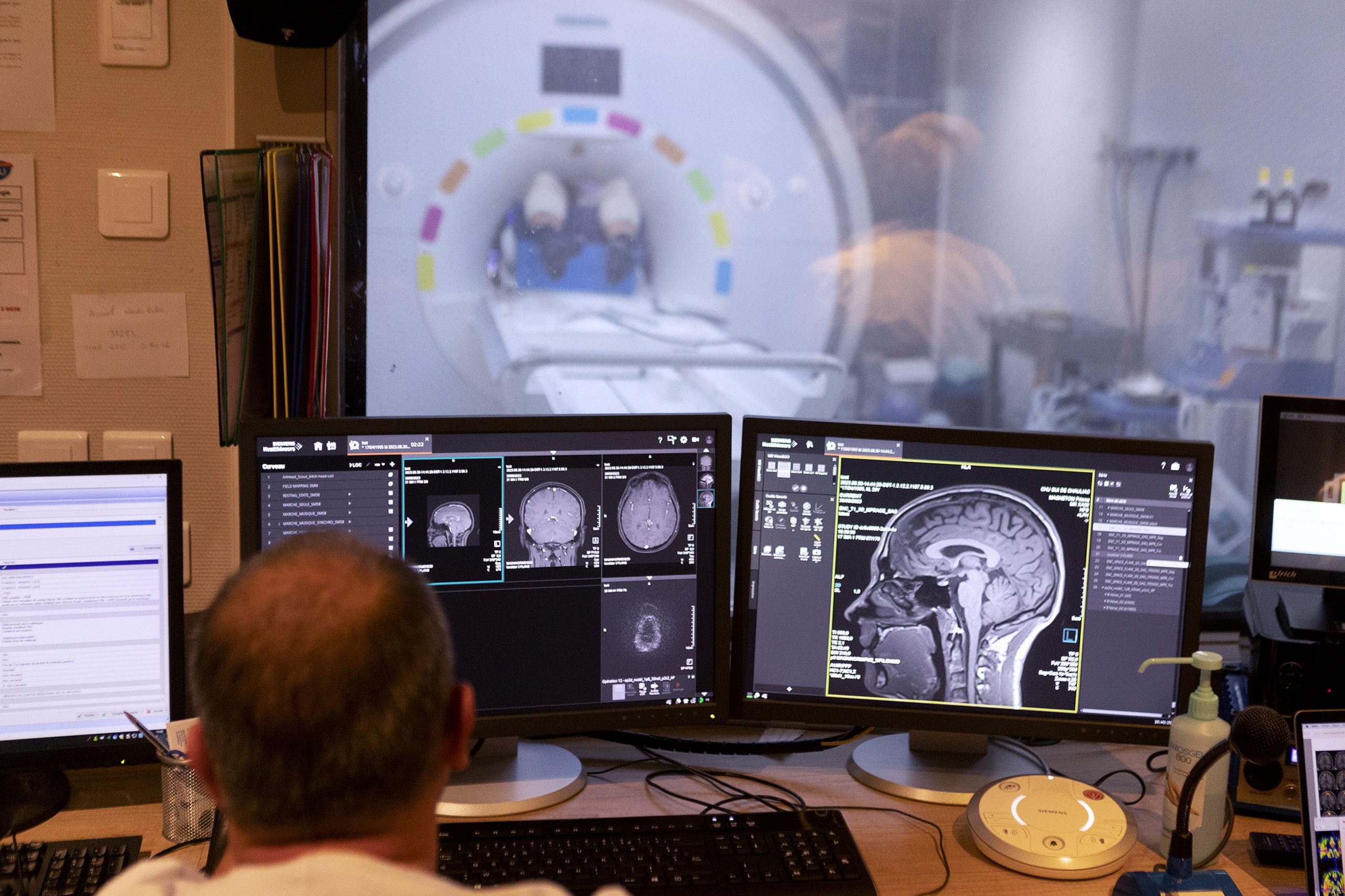Inteligența artificială, utilizată în operațiile pe creier. Tot mai mulți neurochirurgi o folosesc în domeniu