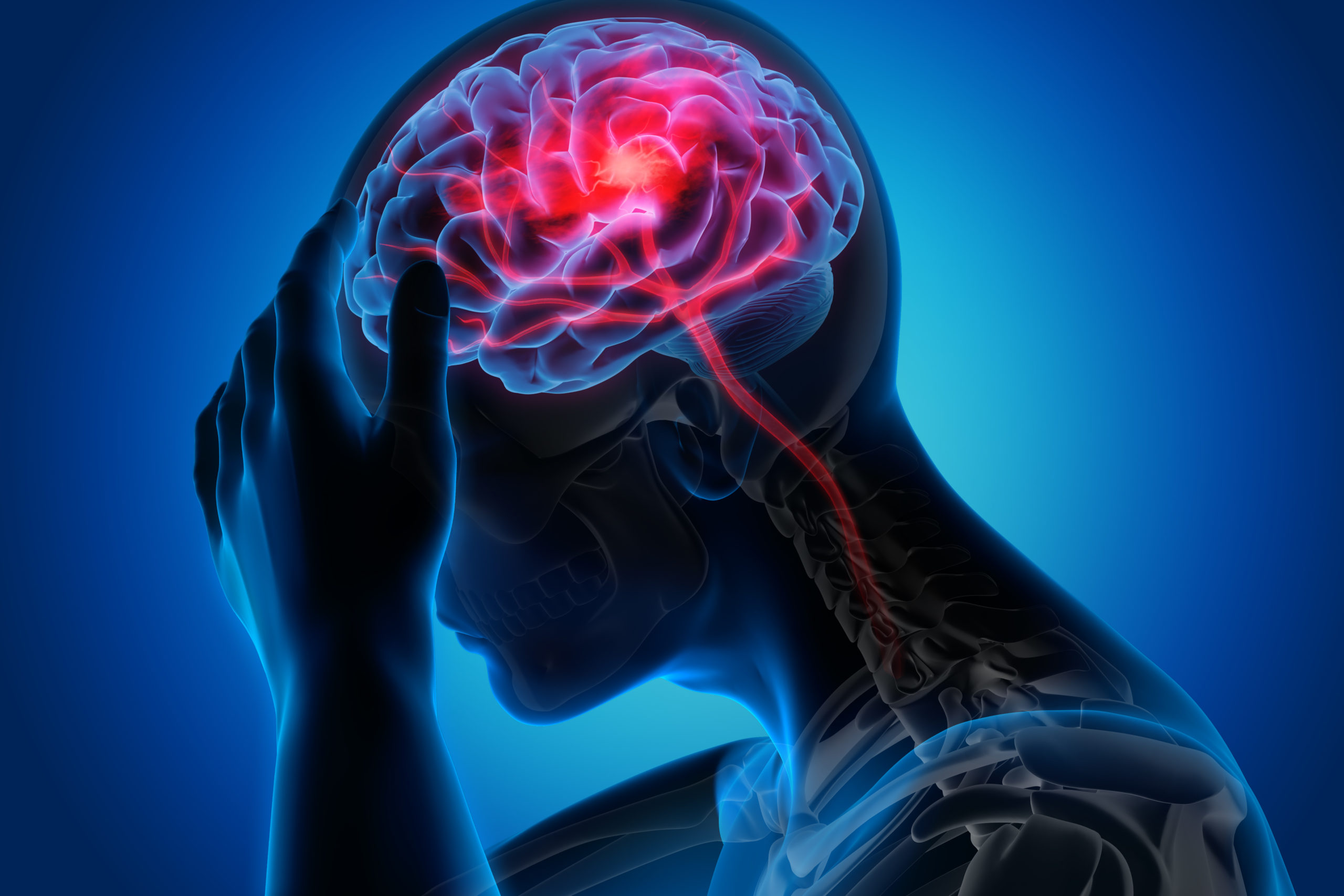 Ziua Mondială a Accidentului Vascular. Peste 60.000 de români suferă un AVC anual