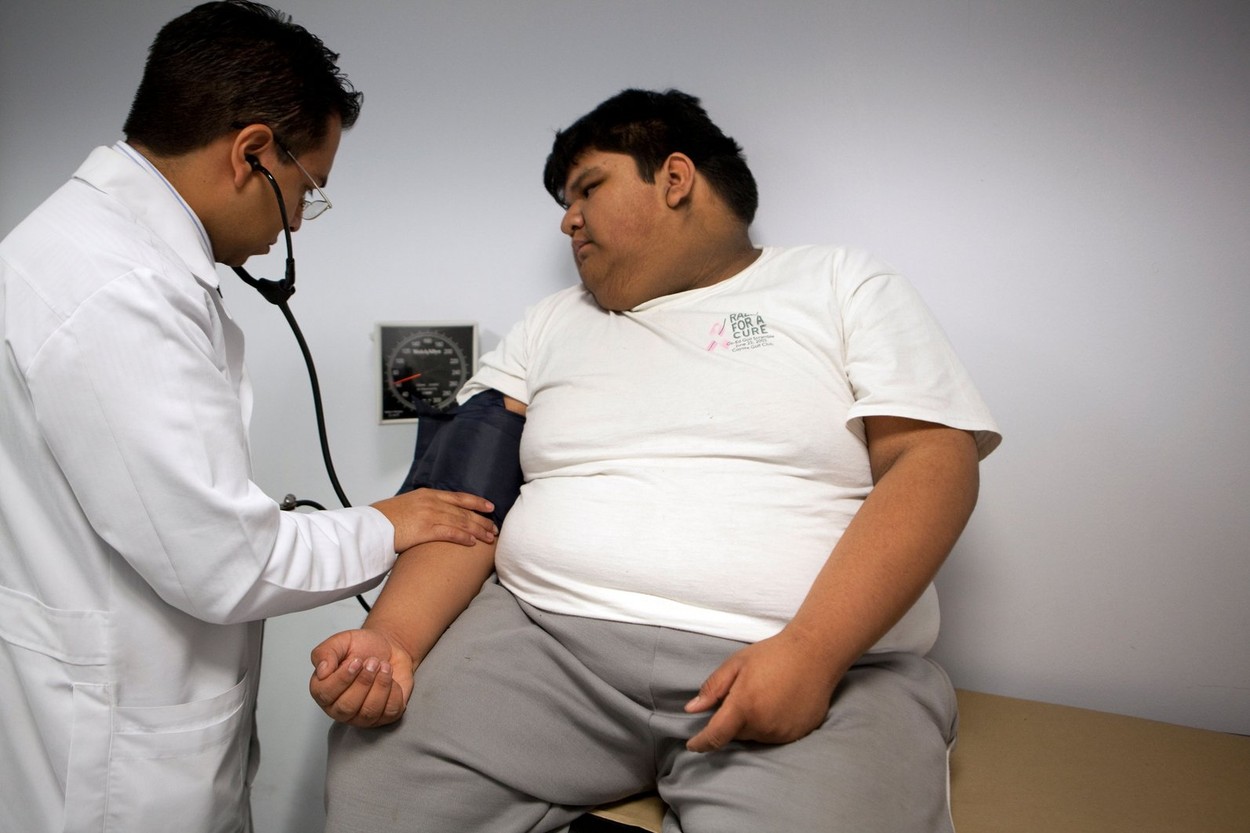 38% dintre copiii din Spania  sunt supraponderali. România este a doua țară europeană care se confruntă cu obezitatea
