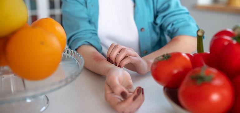 Alergiile scad calitatea vieții