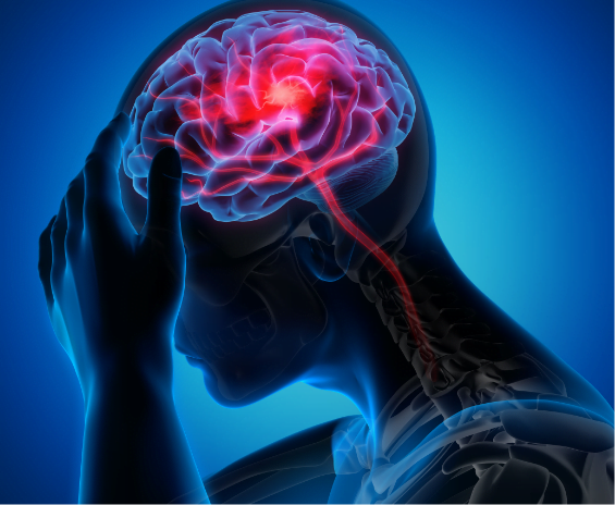 Peste 40% din populația lumii suferă de boli neurologice