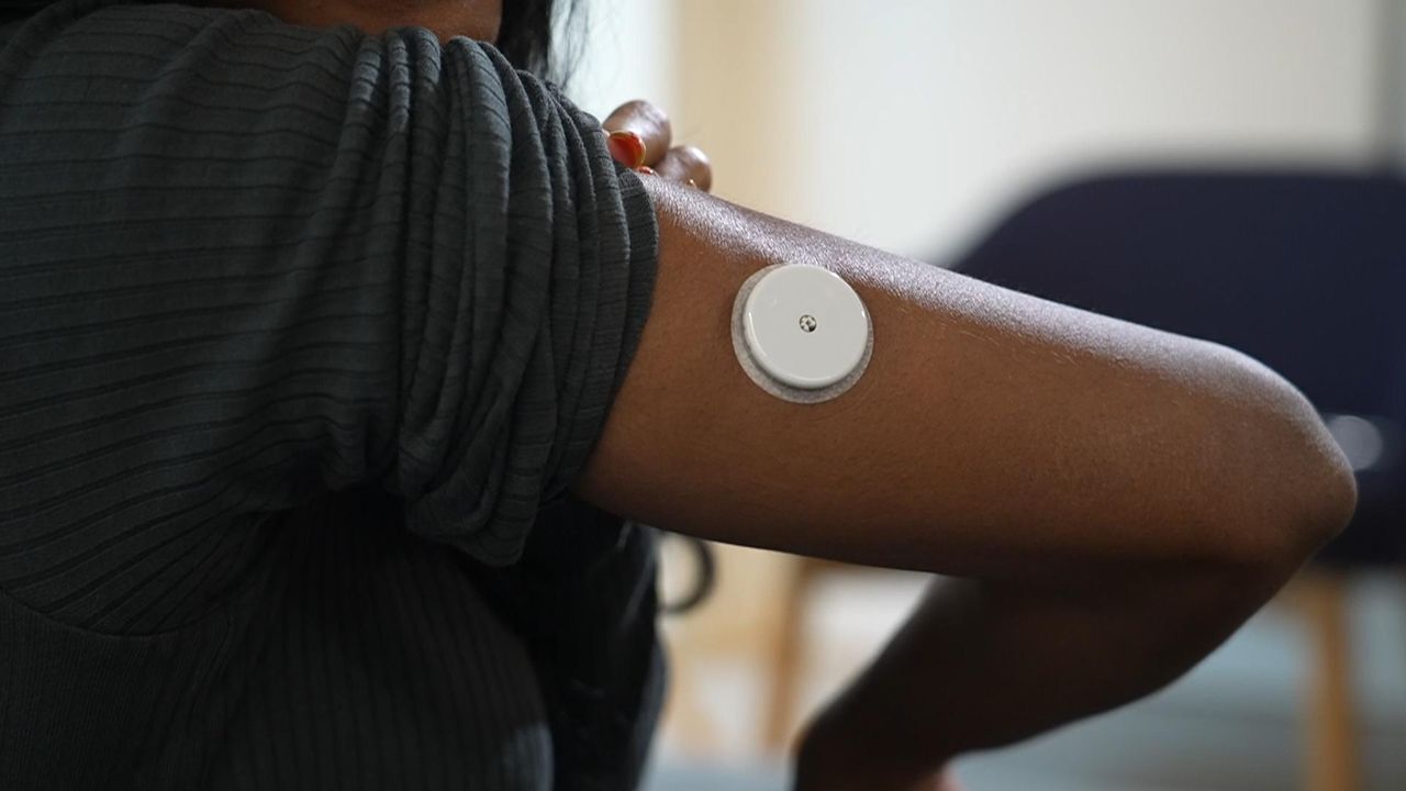 Persoane din Anglia cu diabet de tip 1 vor primi pancreas artificial