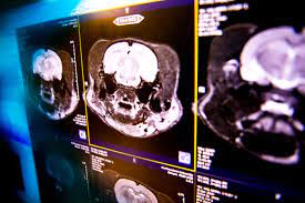 Creierul oamenilor moderni este mai mic decât acum 100k de ani