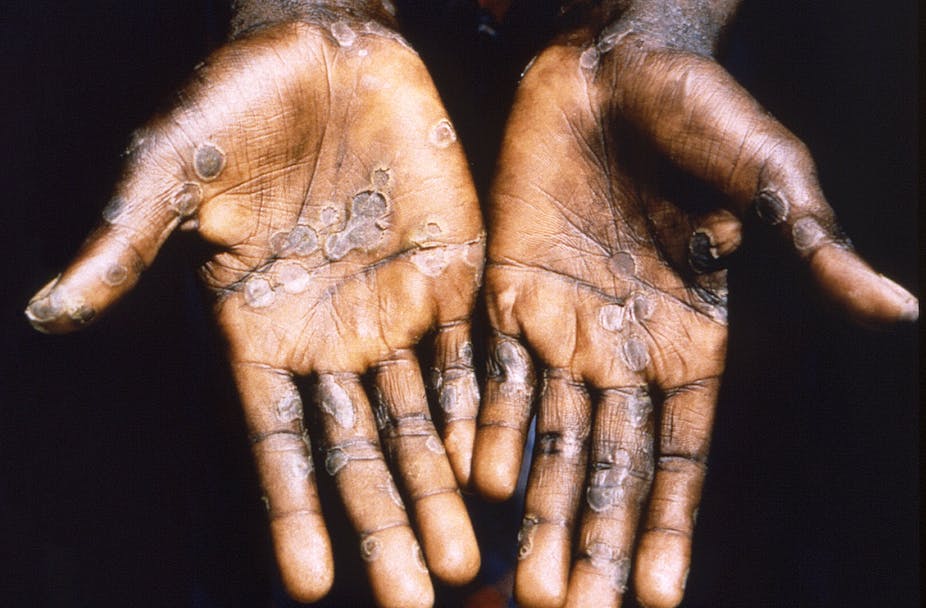 Eșecul de a sprijini țările africane afectate