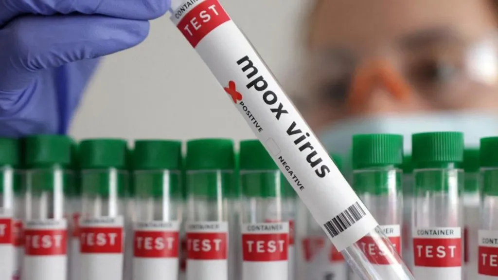 OMS aprobă primul test de mpox pentru diagnosticarea rapidă