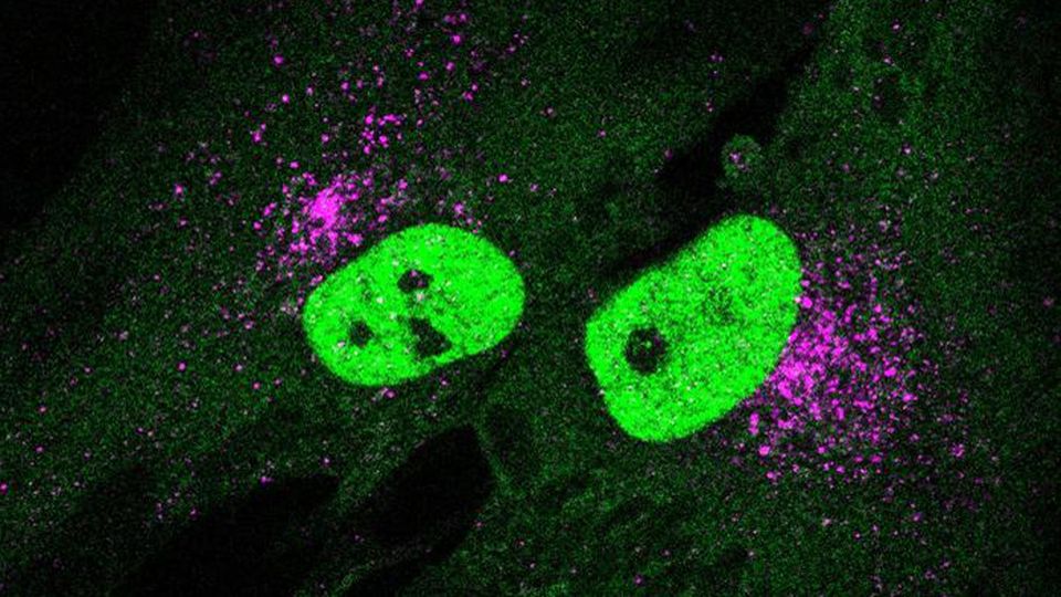 A fost găsită o metodă care ar încetini procesul de îmbătrânire