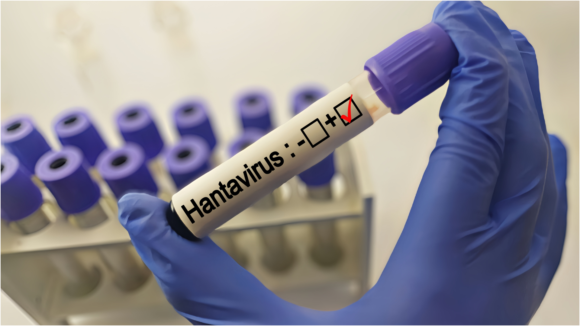Suspiciune de hantavirus la un pacient din Bihor, confirmare în așteptare la Institutul Cantacuzino
